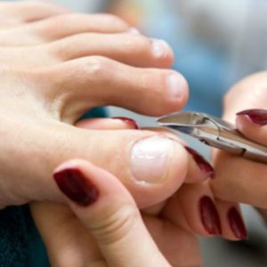 СТРИЖКА НОГТЕЙ НА НОГАХ фото