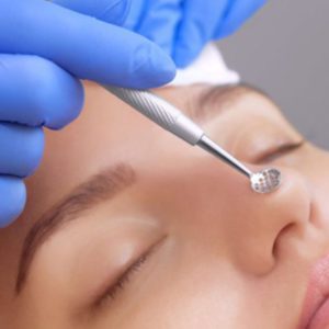 механическая чистка лица фото